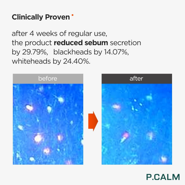 P.CALM Barrier Cycle Toner 200ml